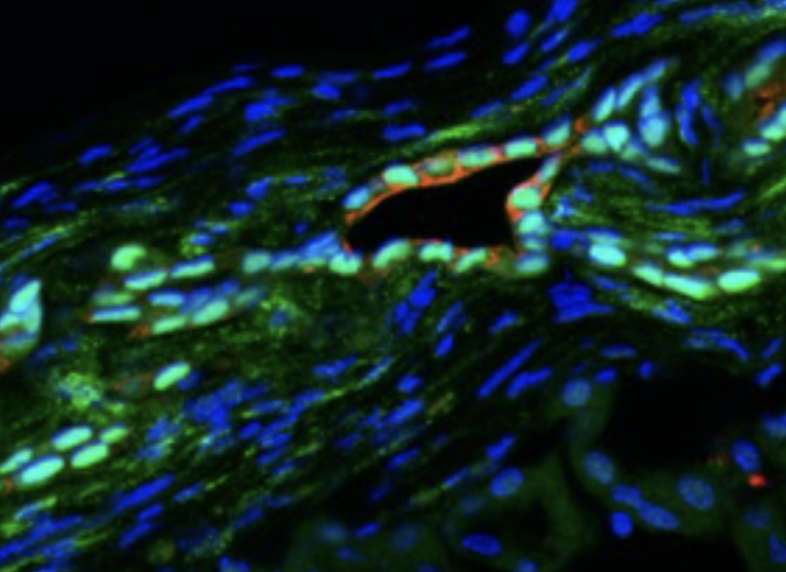 Fluorescence image of ALDH3B2-associated pancreatic duct cell transdifferentiation