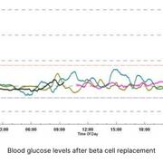 Blood glucose levels after beta cell replacement