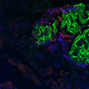 Microscopy image of a pancreas from a diabetic mouse