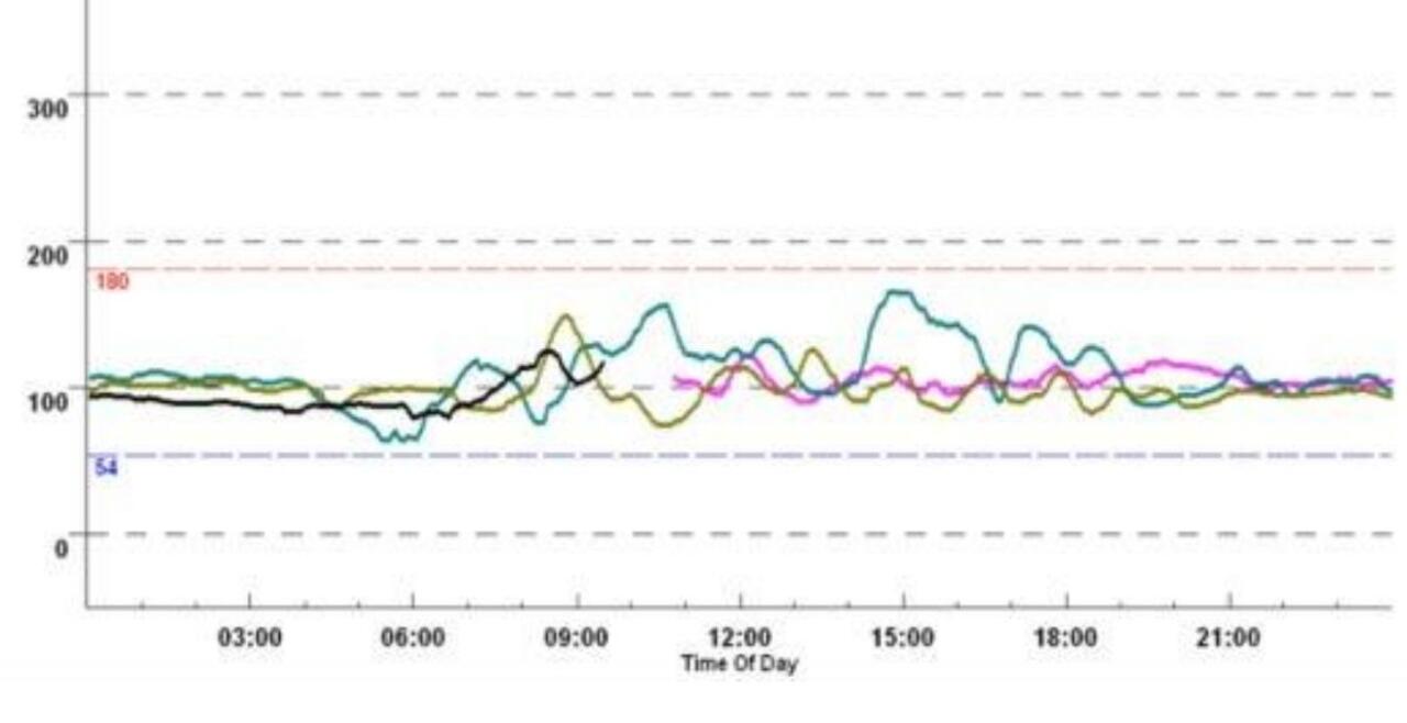 Blood glucose levels after beta cell replacement